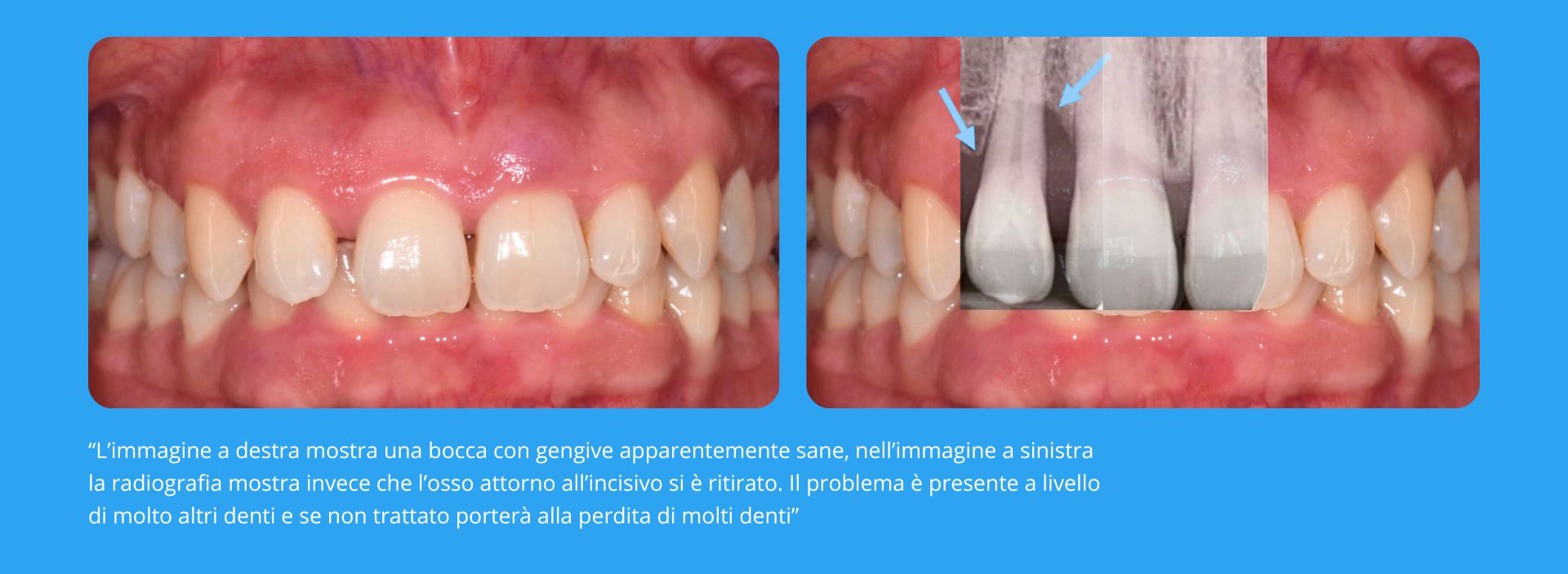 Parodontologia